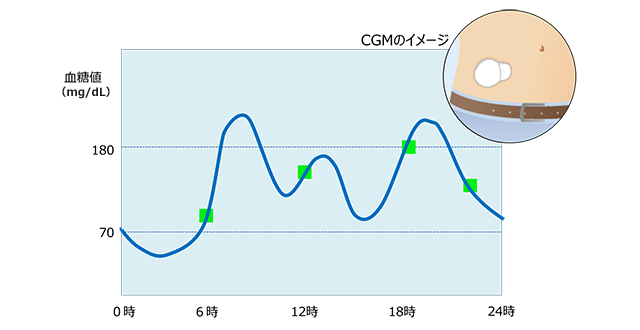 “かくれ血糖”を見える化してみよう！