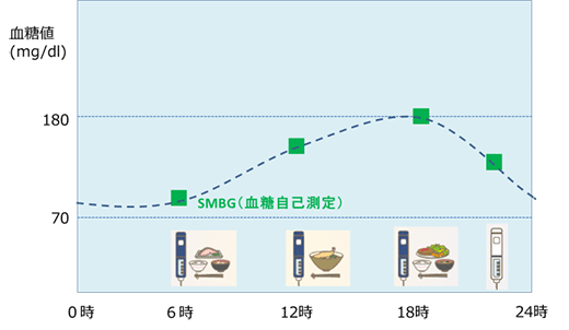 かくれ血糖 かくれた血糖値異常 かくれ血糖 Jp 糖尿病の血糖管理は点から線へ いい明日が見えてくる