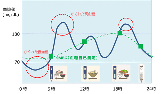 CGM検査の装着イメージ