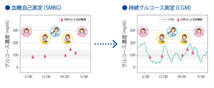 Cgm検査でできること かくれ血糖 Jp 糖尿病の血糖管理は点から線へ いい明日が見えてくる