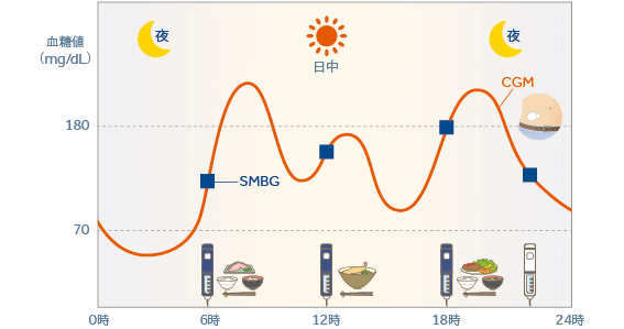 CGMを用いる方法