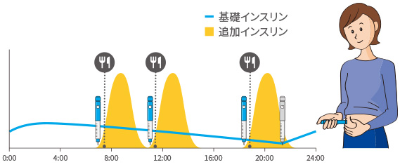 インスリン注射による血糖管理