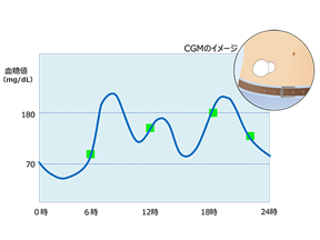 “かくれ血糖”を見える化してみよう！