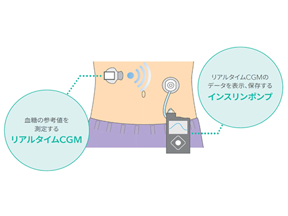 “かくれ血糖”を見える化してみよう！